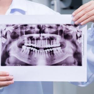 Dental Radiography